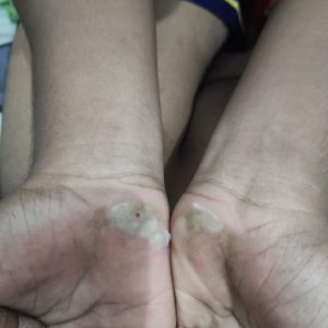 Orangtua Siswa SMKN I Pelayaran Kalipuro Ajak TRC PPA Adukan Ke Polresta Banyuwangi