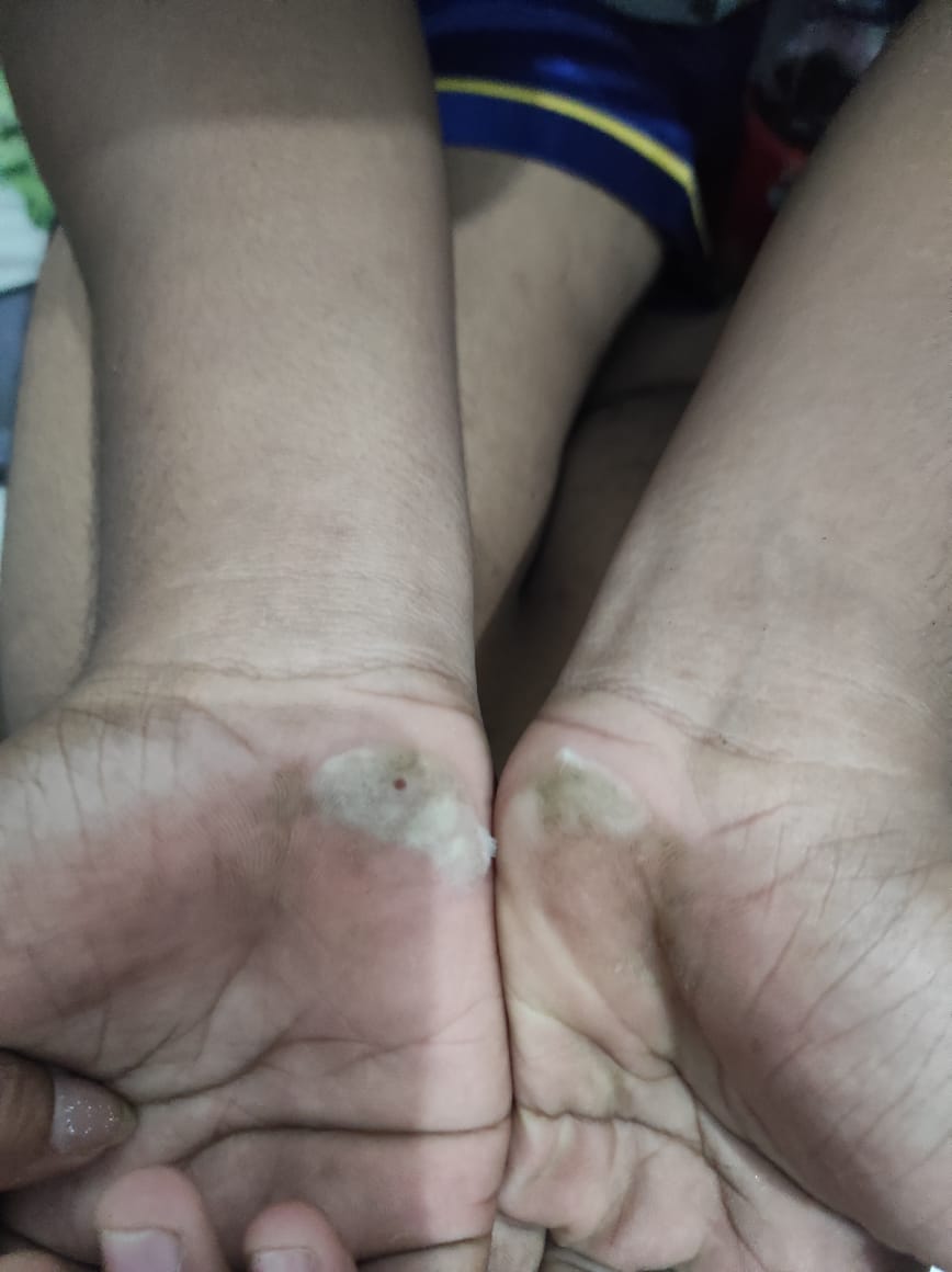 Orangtua Siswa SMKN I Pelayaran Kalipuro Ajak TRC PPA Adukan Ke Polresta Banyuwangi