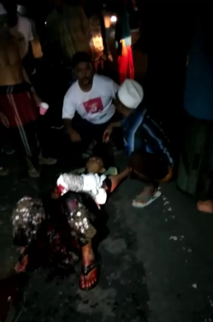 Tunggu Teman, Arek Krengi Dibacok Begal Motor