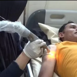 Hapus Tatto Gratis Persembahan RS Bhayangkara Bondowoso