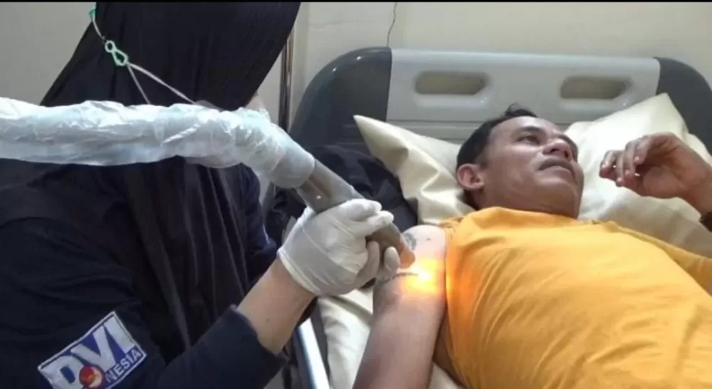 Hapus Tatto Gratis Persembahan RS Bhayangkara Bondowoso