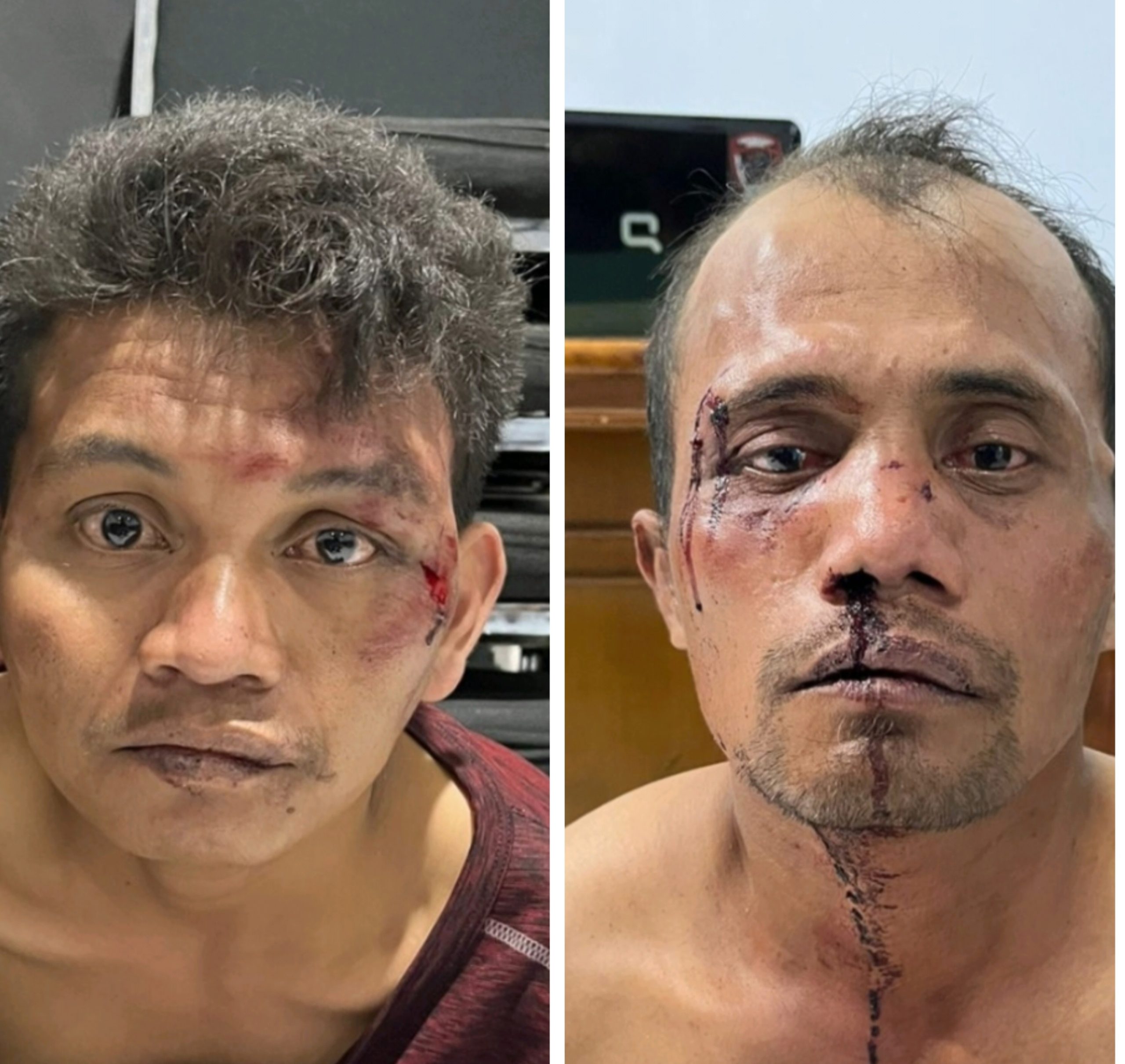 Tertangkap Jambret HP, Bonyok Di Bogem Mentah Warga