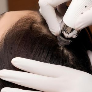 Tren Perawatan Kulit Kepala untuk Kesehatan Rambut Tren Perawatan Kulit Kepala untuk Kesehatan Rambut