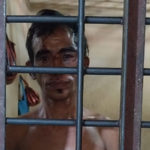 Polisi Tangkap Pencuri Ponsel, Pelipis Matanya Berdarah Saat Massa Mengamuk