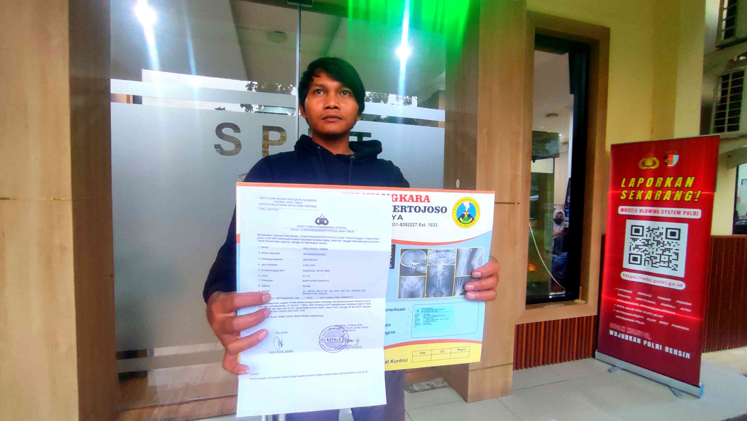 Faisol Laporkan Dugaan Penganiayaan di Lapas Kelas II A Kediri ke Polda Jatim, Kaki Berpen Menjadi Bukti